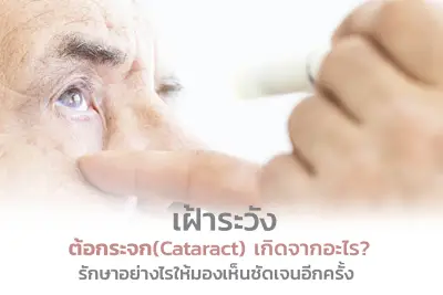  เฝ้าระวังต้อกระจก (Cataract) เกิดจากอะไร รักษาอย่างไรให้มองเห็นชัดเจนอีกครั้ง