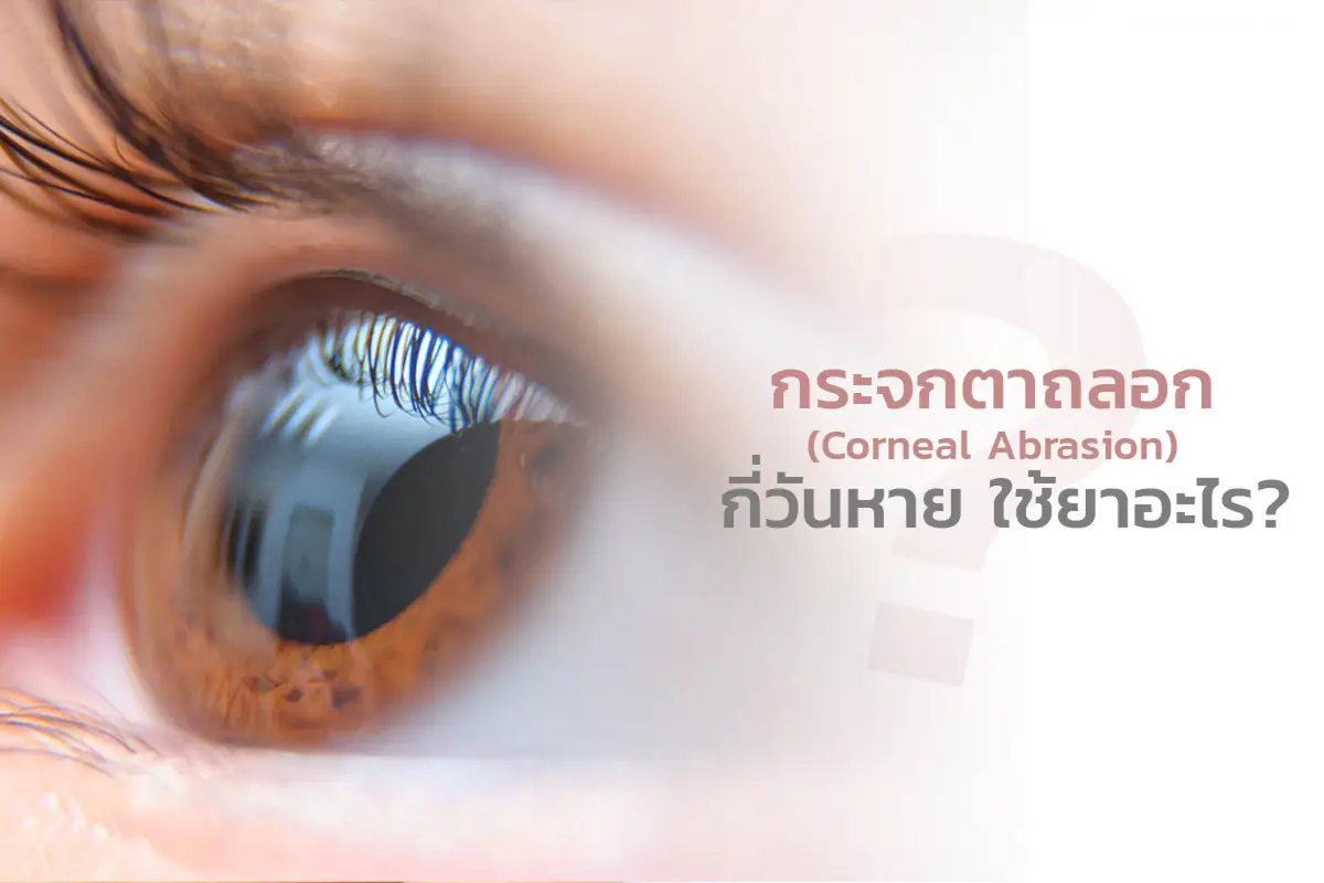  กระจกตาถลอก (Corneal Abrasion) กี่วันหาย ใช้ยาอะไร