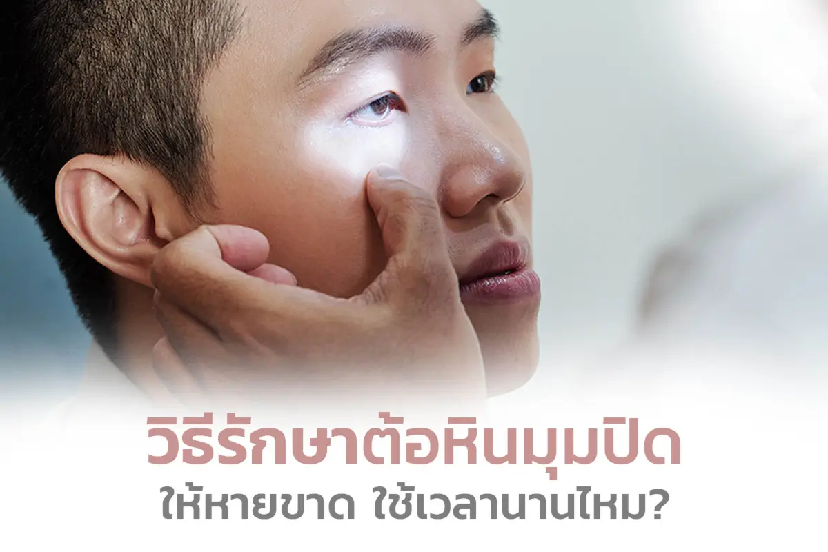  ต้อหินมุมปิดรักษาอย่างไรให้หายขาด ใช้เวลานานไหม