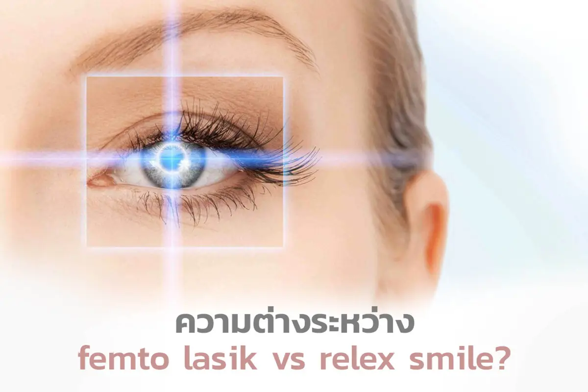  ความต่างระหว่าง Femto Lasik vs ReLEx SMILE?