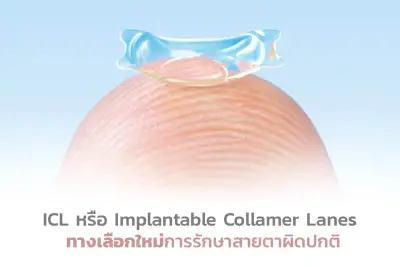  ICL หรือ Implantable Collamer Lens ทางเลือกใหม่การรักษาสายตาผิดปกติ