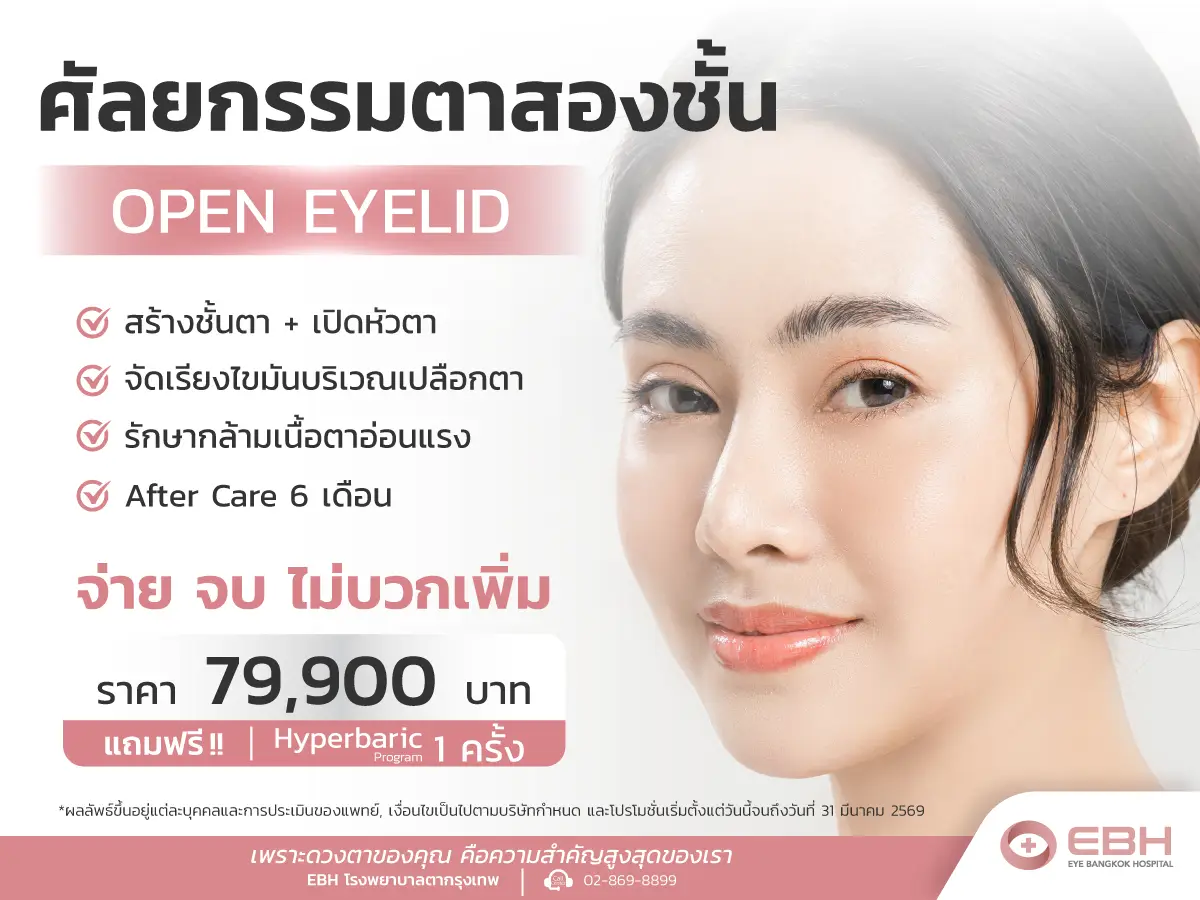 โปรโมชั่นตาสองชั้น โปรจ่าย จบ 79,900.-